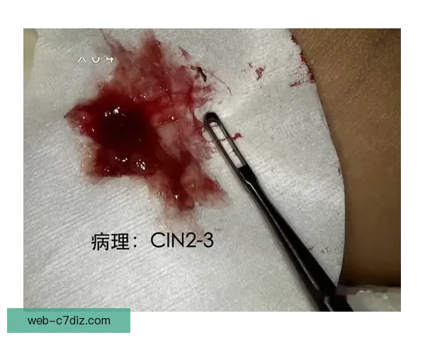 官方通报小贾伦手术四周后复查